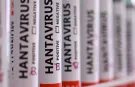 Türkiye’de hantavirüs vakası var mı? Sağlık Bakanlığı açıkladı