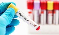 Uzmanından hepatit uyarısı!