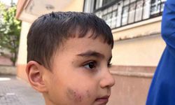 Evde uyuyan çocuğu lağım faresi ısırdı