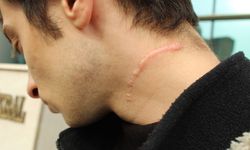 Eskişehir terminalindeki bıçaklı saldırı davası istinafa taşındı