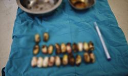 Eskişehir'de ilginç olay: Bakın midesinde ne taşımış?