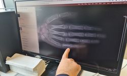 Lösemi vakaları artıyor mu? Uzmandan açıklama!