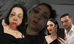 Kafede dehşet: Anne oğul darp edildi!