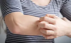 Sivrisinekler bazı insanları neden daha çok ısırıyor?