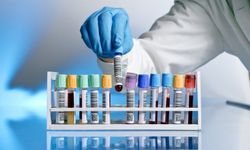 Tıbbı biyokimya lab malzemeleri alınacak