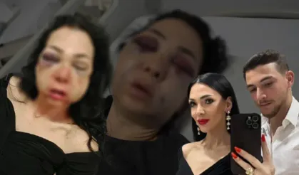 Kafede dehşet: Anne oğul darp edildi!