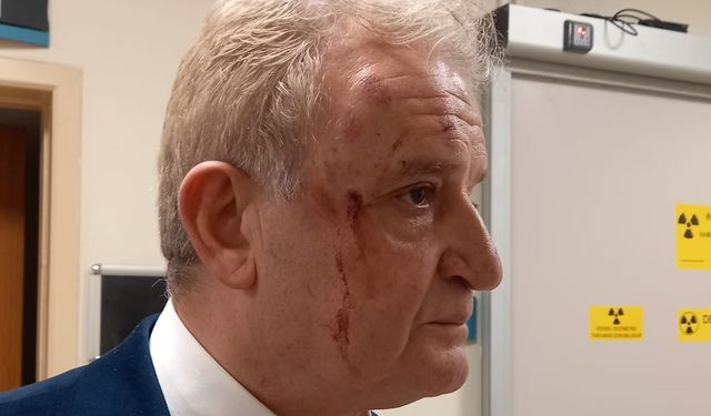 Gazetemizin Yazı İşleri Müdürü Hakkı Sağlam'a alçak saldırı!