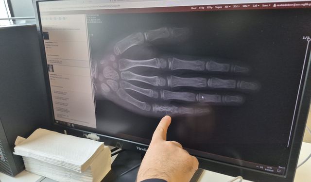 Lösemi vakaları artıyor mu? Uzmandan açıklama!