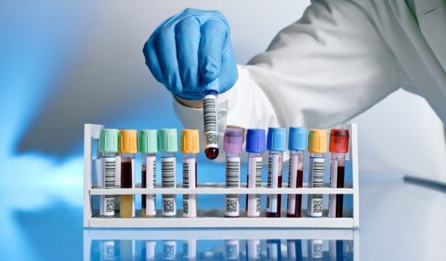 Tıbbı biyokimya lab malzemeleri alınacak