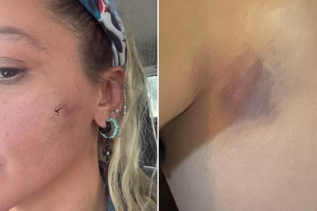 Yildiz Asyali Kocasindan Siddet Gordugunu Acikladi 19337201 8130 Amp